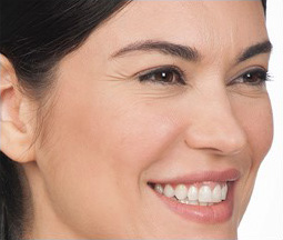 BOTOX® Cosmetic Before and After Pictures Houston, TX