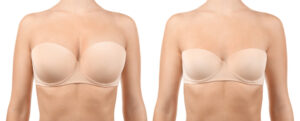 Breast Reduction Pearland